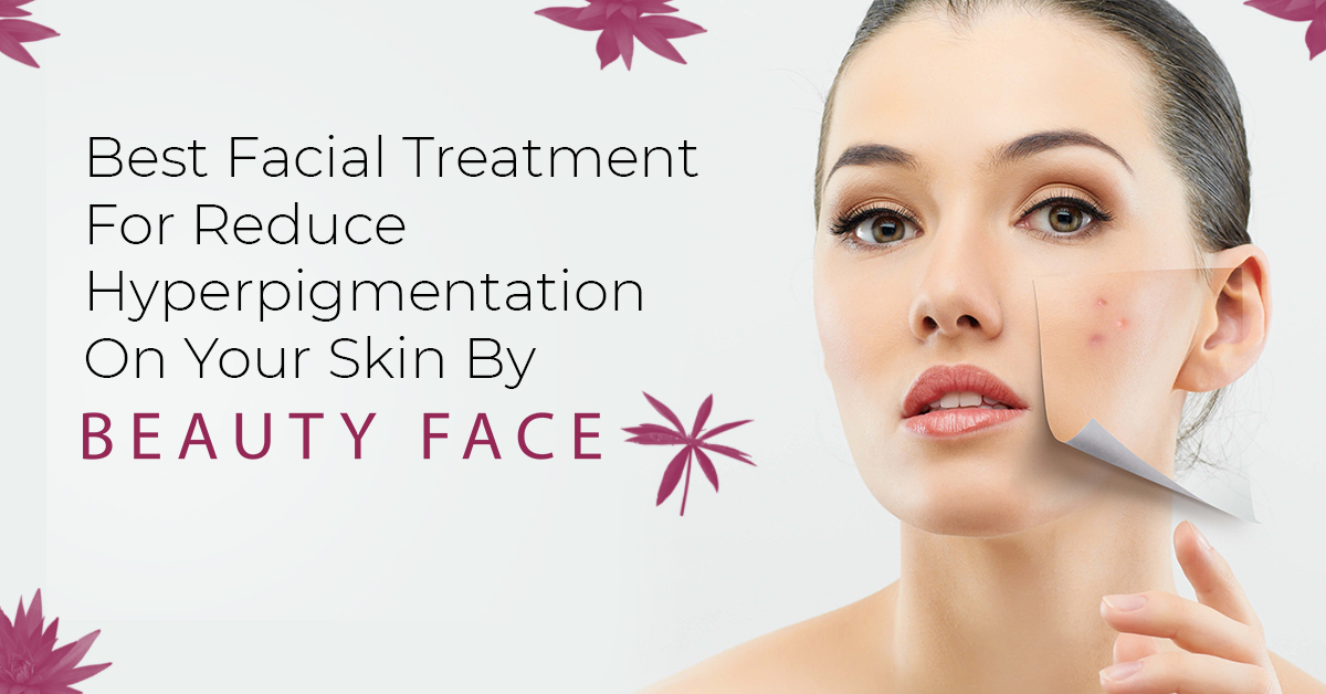 Best Facial Treatment For Hyperpigmentation