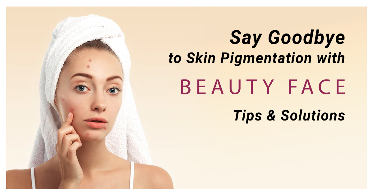 Say Goodbye to Skin Pigmentation with Beauty Face Tips & Solutions