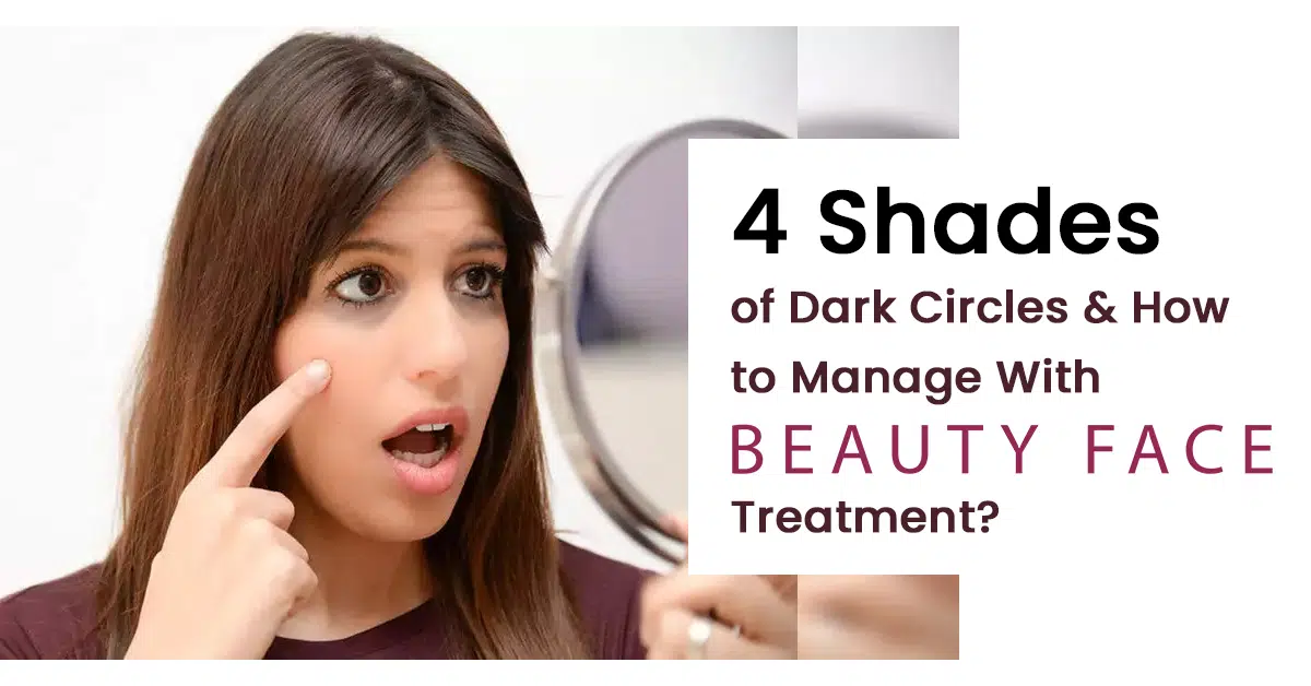4 Shades of Dark Circles and How to Manage With Beauty Face Treatment?