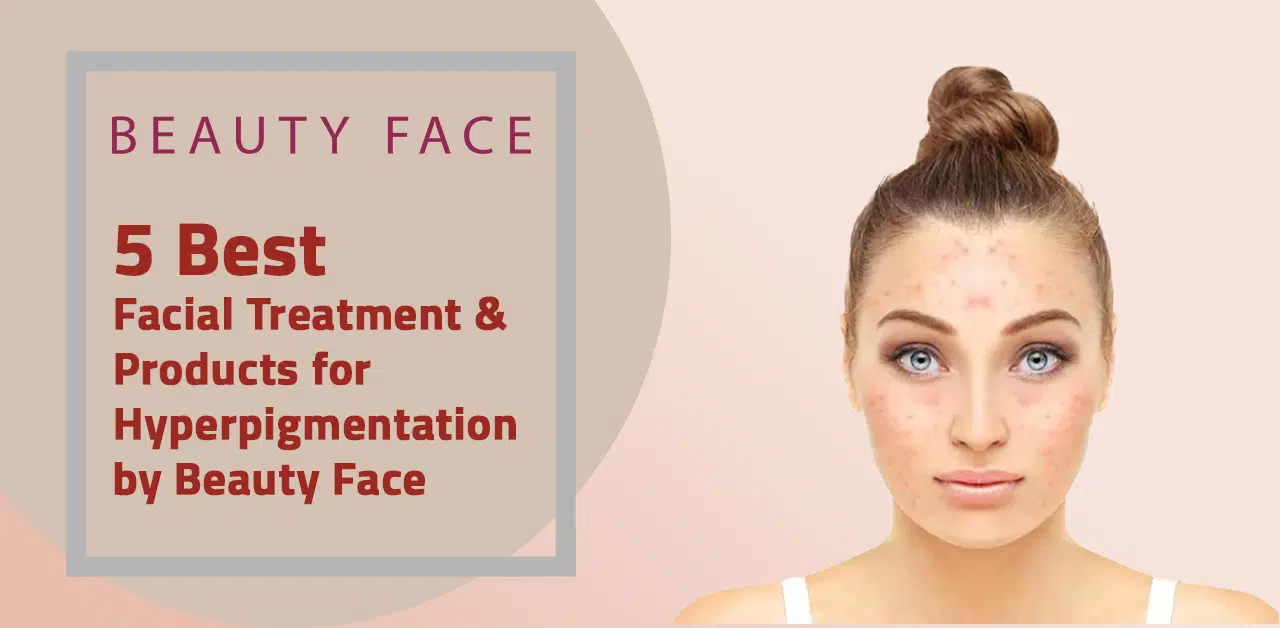 5 Best Facial Treatment & Products for Hyperpigmentation by Beauty Face