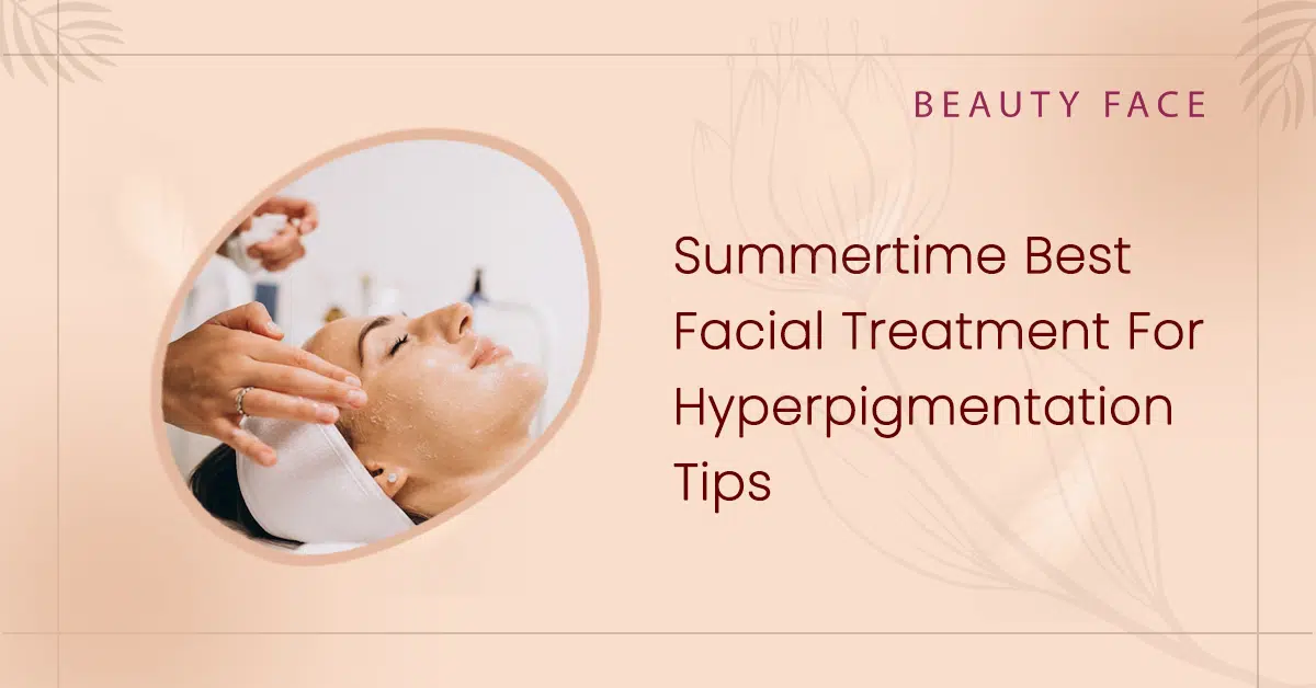 Summertime Best Facial Treatment For Hyperpigmentation Tips